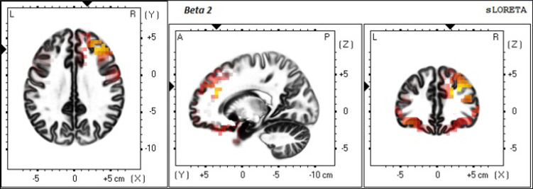 Figure 1: