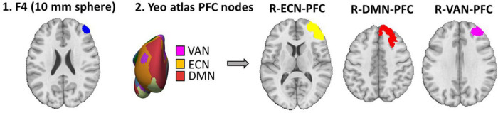 FIGURE 2