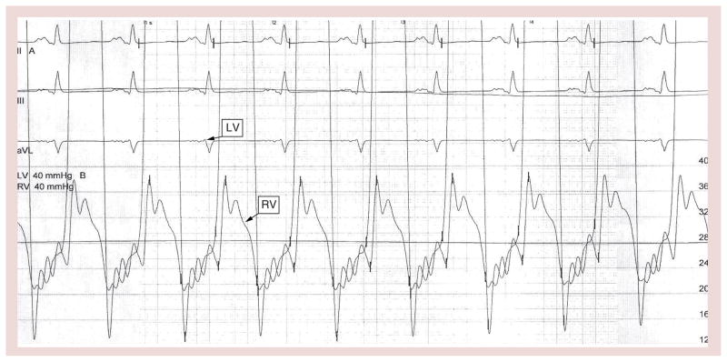 Figure 18