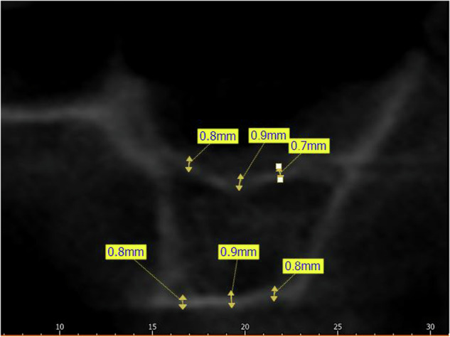 Fig. 2