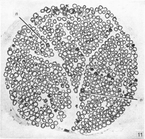 Fig. 11