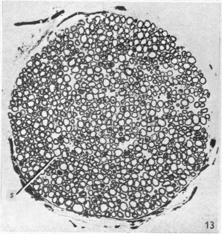 Fig. 13