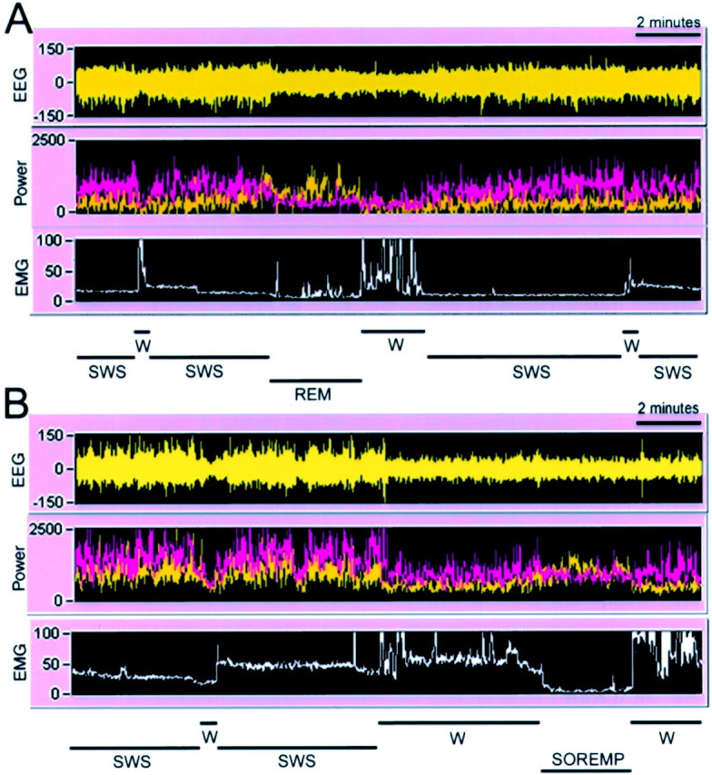 Fig. 11.