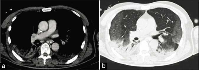 Figure 5: