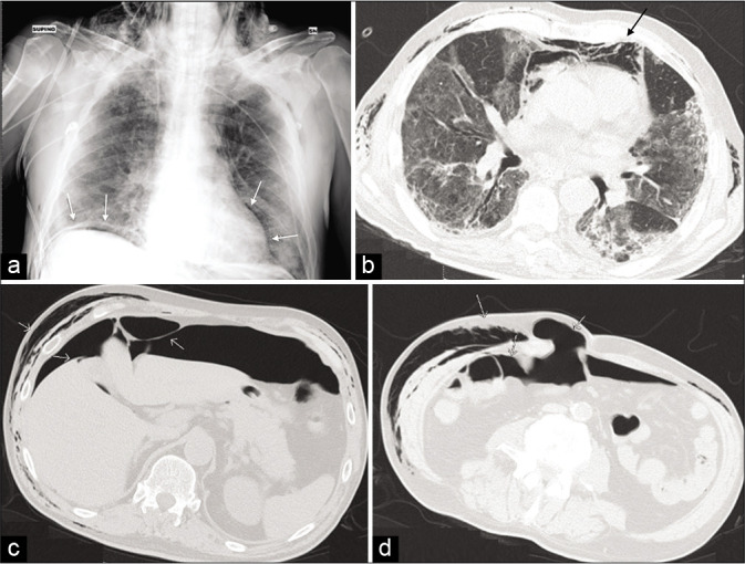 Figure 4: