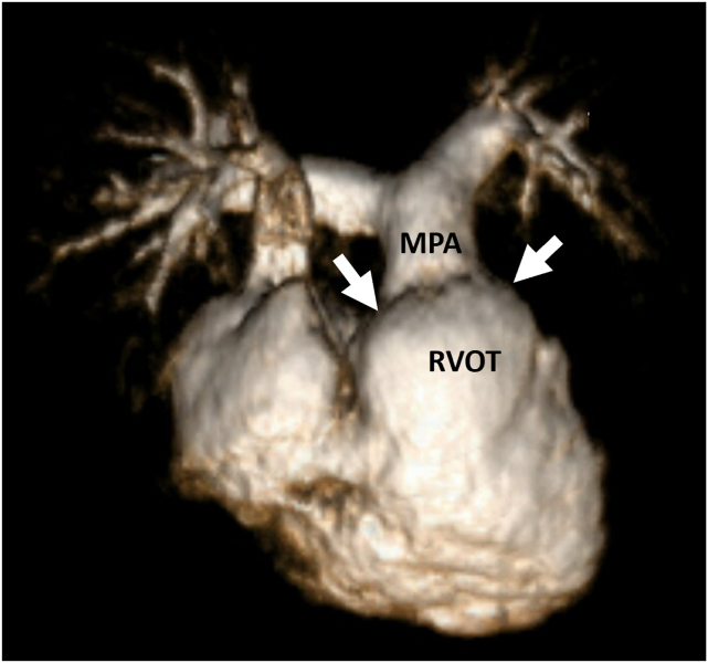 Figure 3