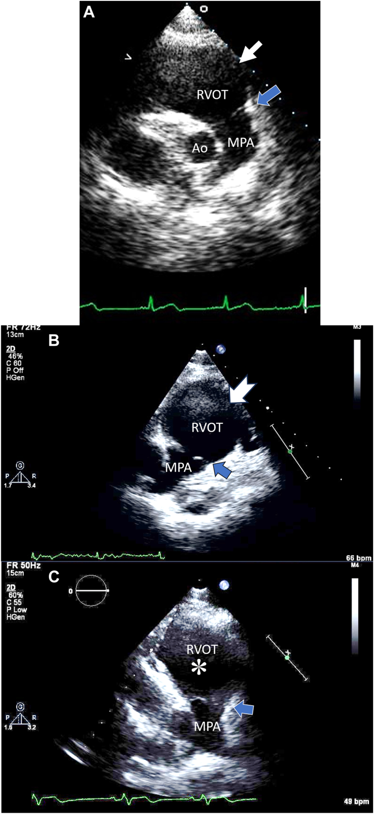 Figure 2