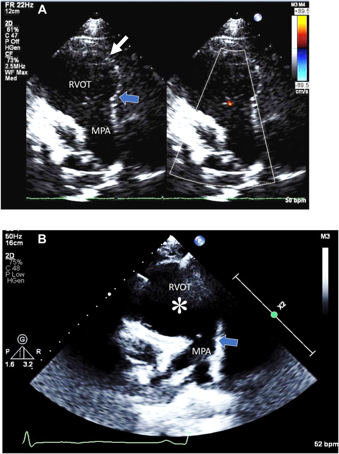 Figure 4