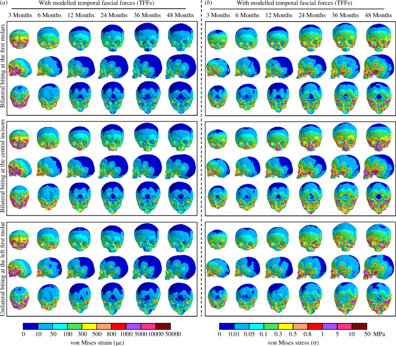 Contour plots of von Mises strains (a) and stresses (b) over the skull models at 3, 6, 12, 24, 36 and 48 months of age under three simulated biting modes with temporal fascia loads, reported in anterior