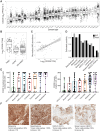 Figure 1. CD228 is expressed in solid tumors. A, CD228 RNA levels were obtained from TCGA. Abbreviations are defined in Supplementary Table S1. B, Log2-transformed FPKM values of CD228 RNA-seq data in TCGA-BRCA breast cancer subtypes. C, Correlation between CD228 RNA-seq (TPM) and publicly available (via CPTAC) CD228 MS values in matched TCGA-BRCA samples (Pearson correlation coefficient shown). D, Tumor microarrays (n > 49/tumor type) were stained for CD228 using commercial rabbit polyclonal antibody. The prevalence of CD228-positive samples by IHC was calculated as the number of samples with any CD228 staining relative to total samples tested in the TMA dataset for a particular tumor type. Prevalence of CD228 positivity by RNA was estimated from the TCGA dataset under the assumption of equal prevalence from both IHC and RNA in the melanoma samples. Using this assumption, we were able to calculate an RNA cutpoint in TCGA and apply it to the nonmelanoma TCGA cohorts. E, Full tumor sections were stained with a novel IHC-optimized anti-CD228 monoclonal antibody. CD228 positivity was assessed by a pathologist using both percent tumor cells staining and H-score metrics. F, Representative examples of the mean H-score staining in (E). Note that the RNA and MS data in this figure were extracted from the OmicSoft omics portal.