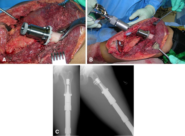 Fig. 1A–C