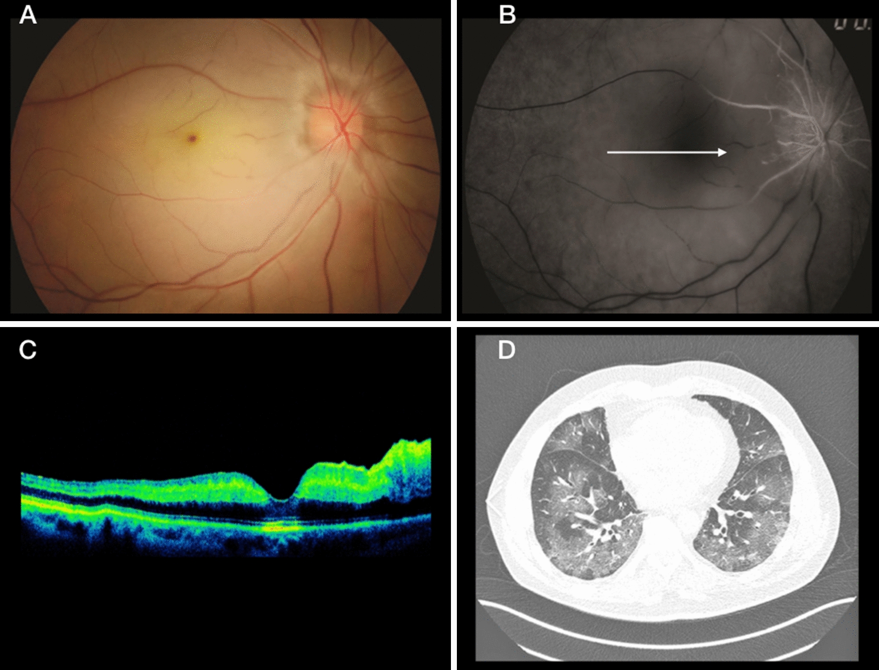 Fig. 2