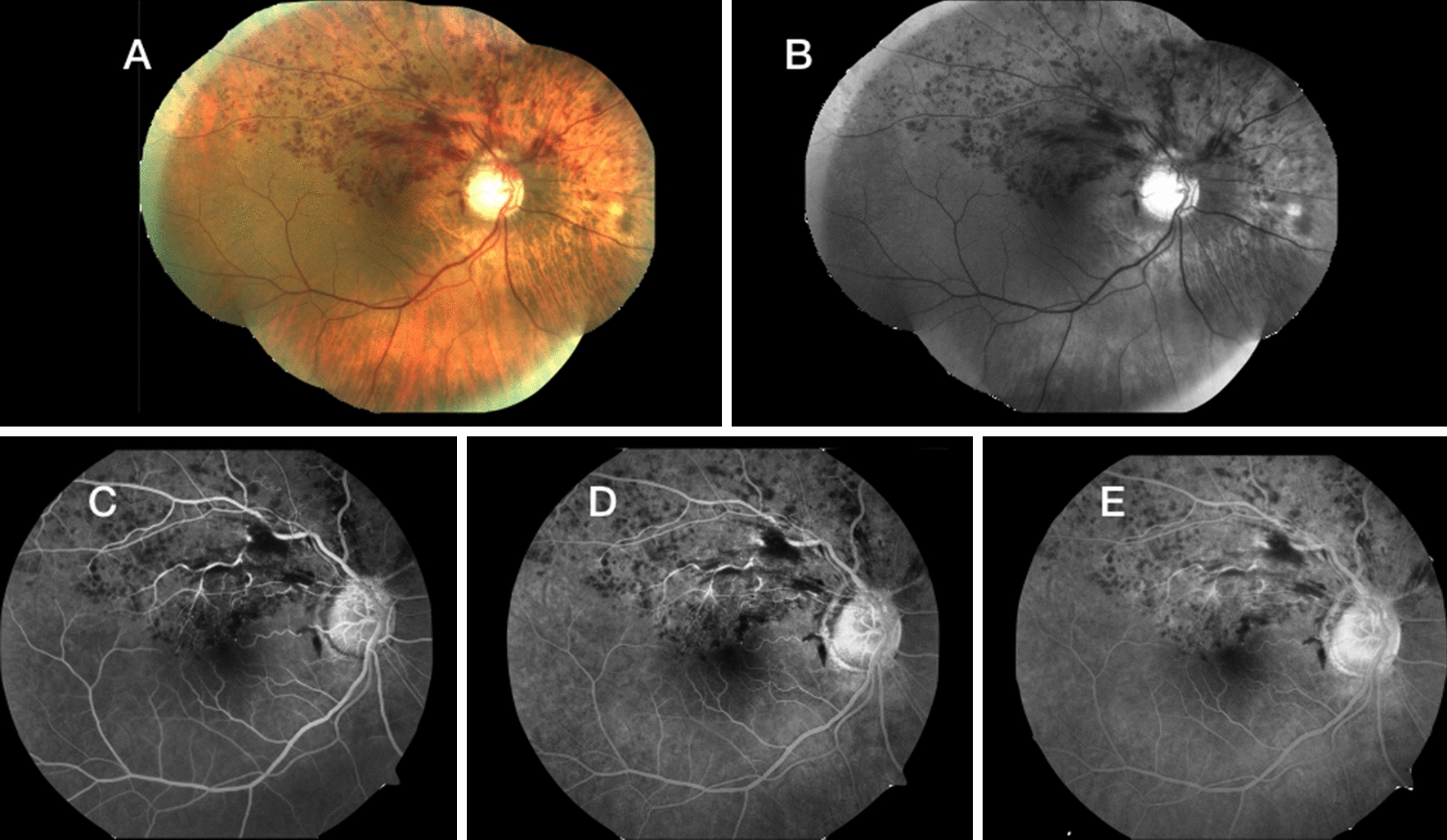 Fig. 1