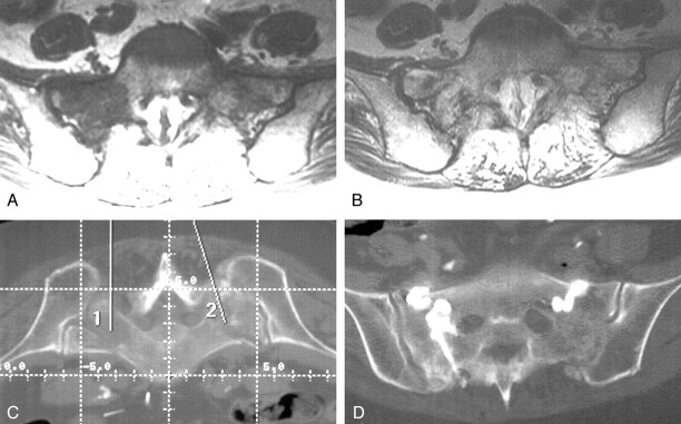 Fig 3.