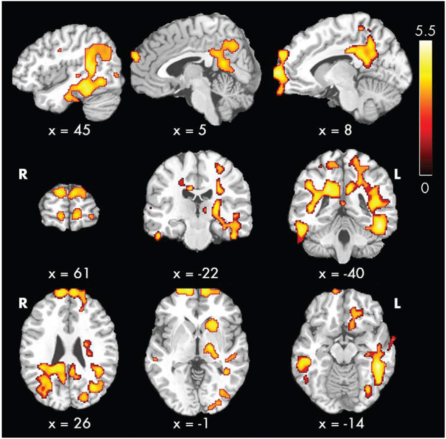 Figure 1 -