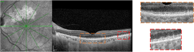 Fig. 3