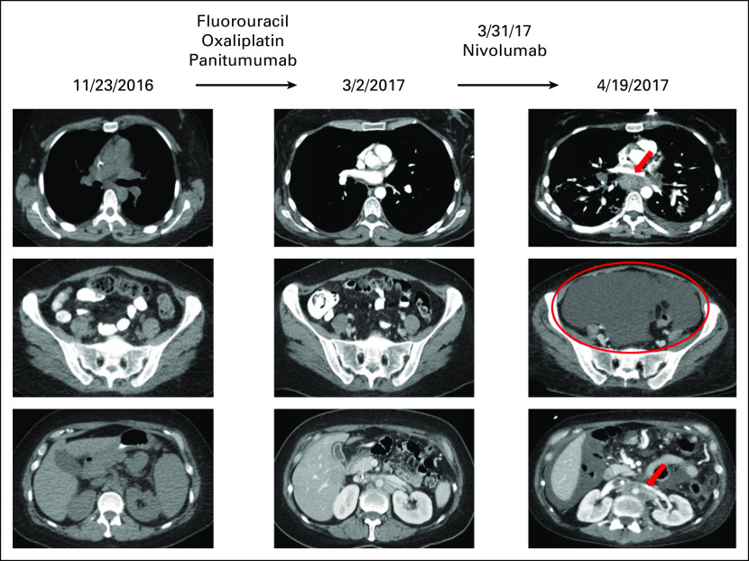 Fig 3.