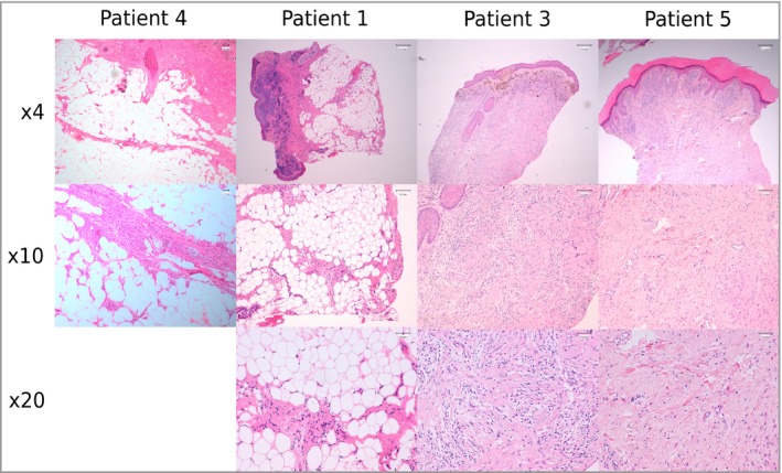 Figure 4