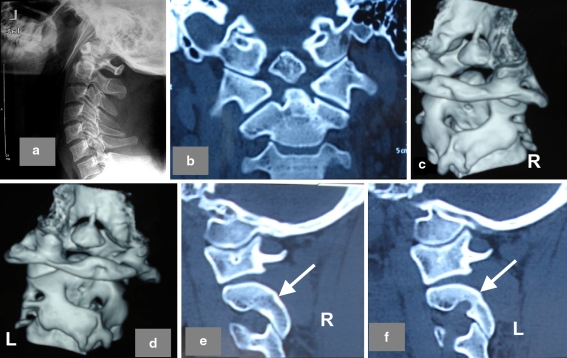 Fig. 3