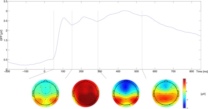 FIGURE 3