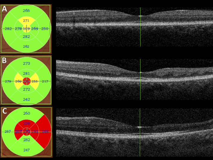 Fig. 1