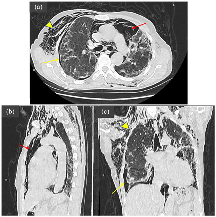 Figure 2.