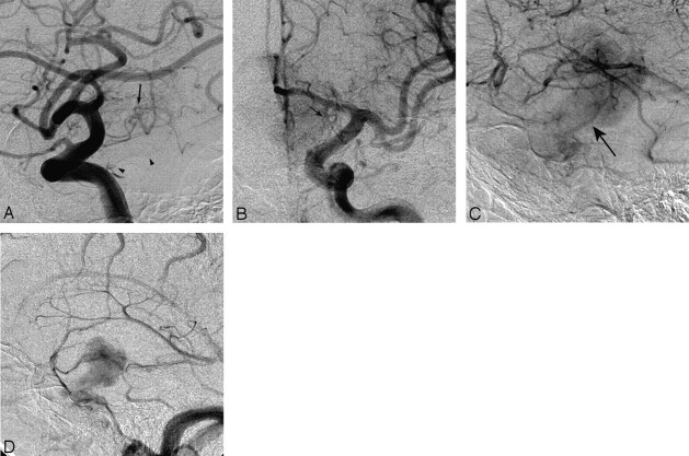 Fig 2.