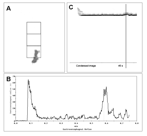 Fig. 11