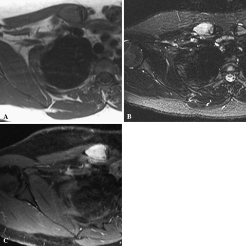 Fig. 3A–C