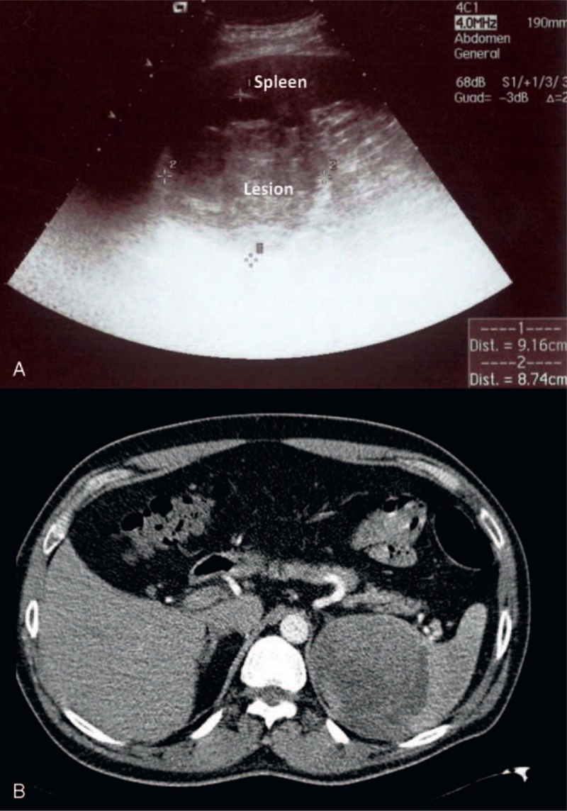 FIGURE 1