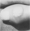 93