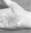 92