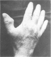 92