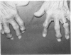 93