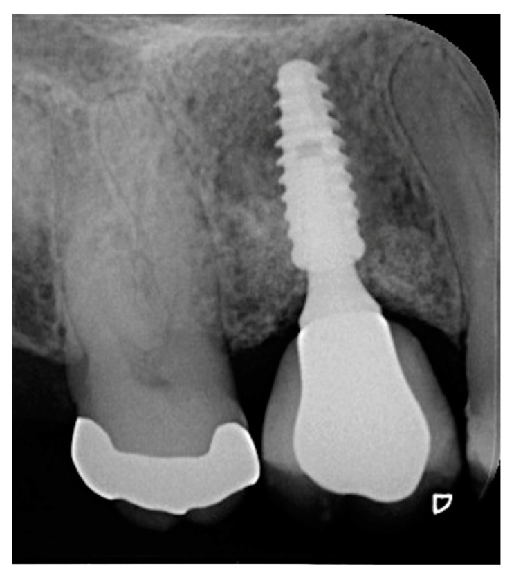 Figure 18