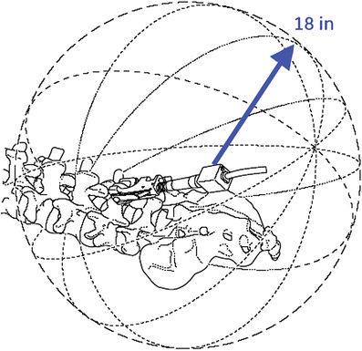 Fig. 1