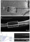 Fig. 2.