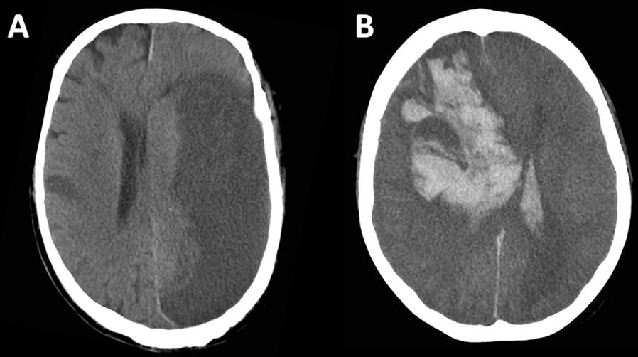 Fig. 2