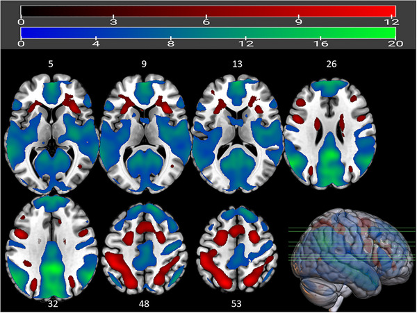 FIGURE 3