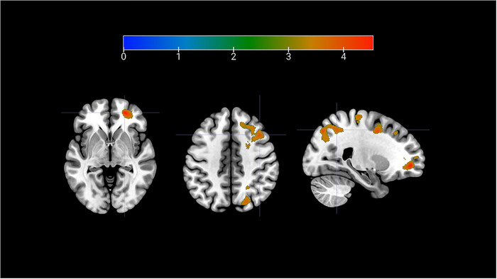 FIGURE 4