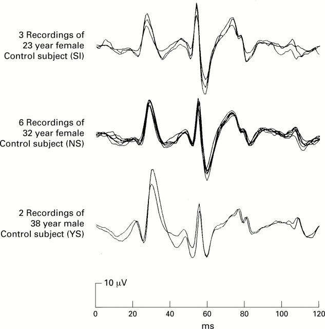 Figure 3  