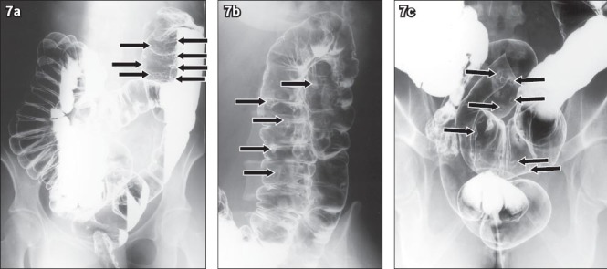 Fig. 7