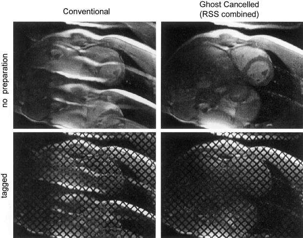 FIG. 6