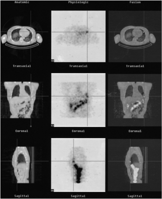 Fig. 2