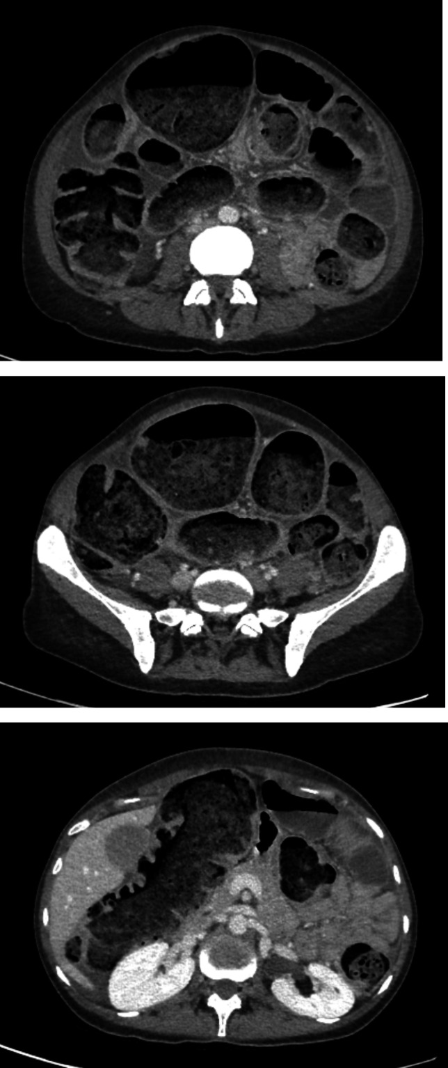 Fig. 3