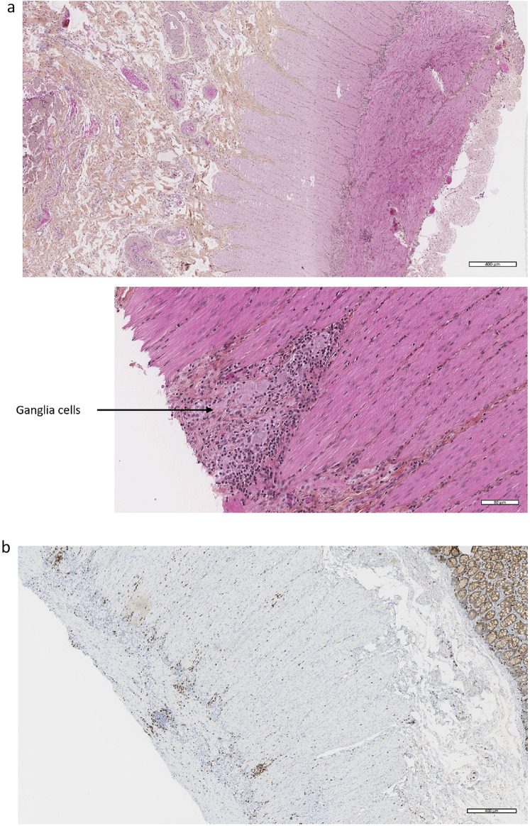 Fig. 2