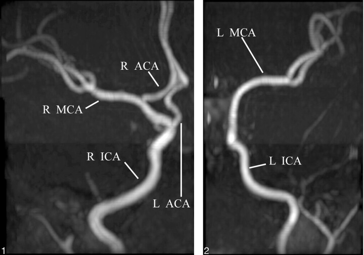 Fig 1.