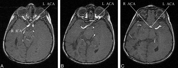 Fig 3.