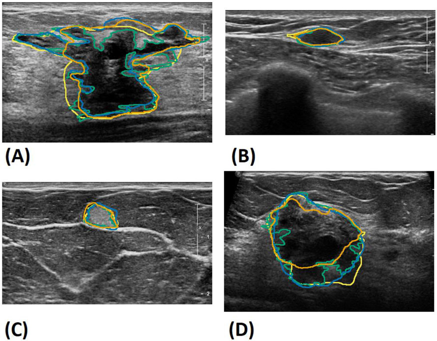 Fig.5.