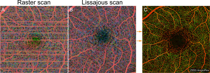 Fig. 13